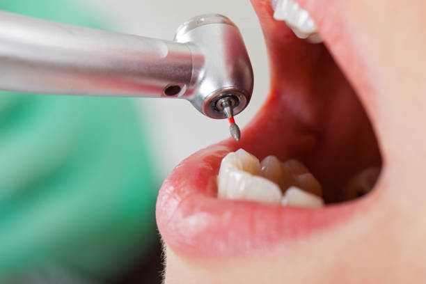 Best Emergency Dental Care for Trauma or Injury in El Cerro, NM